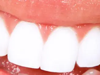 dientes mas blancos